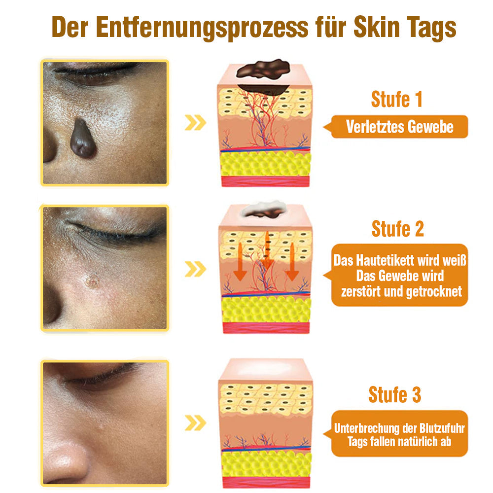 TagRecede Bee Gift Spray | Naturlig Hudperfeksjon | Skanto