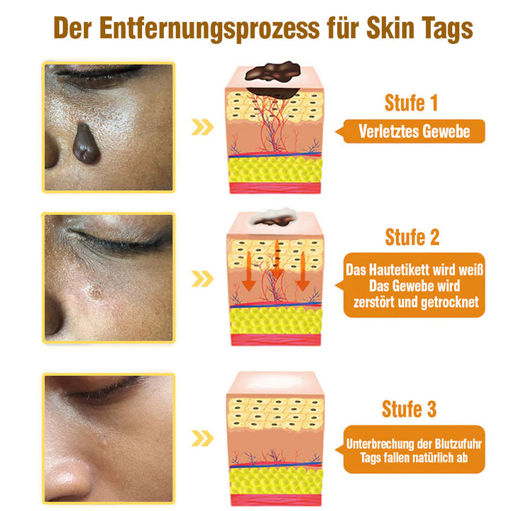 TagRecede Bee Gift Spray | Naturlig Hudperfeksjon | Skanto