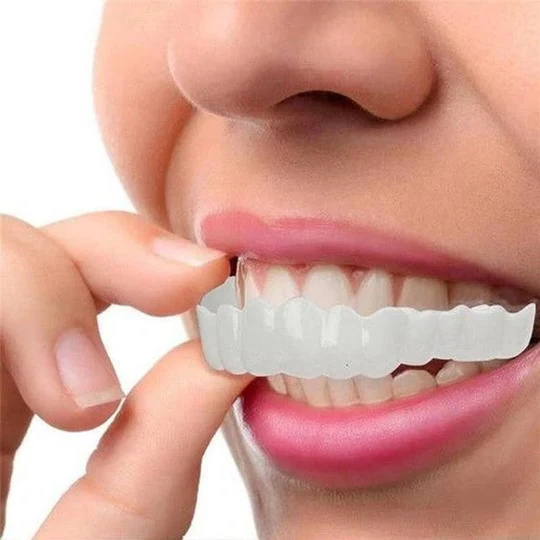 Skanto | Smile Veneer (Øvre & Nedre Inkludert)