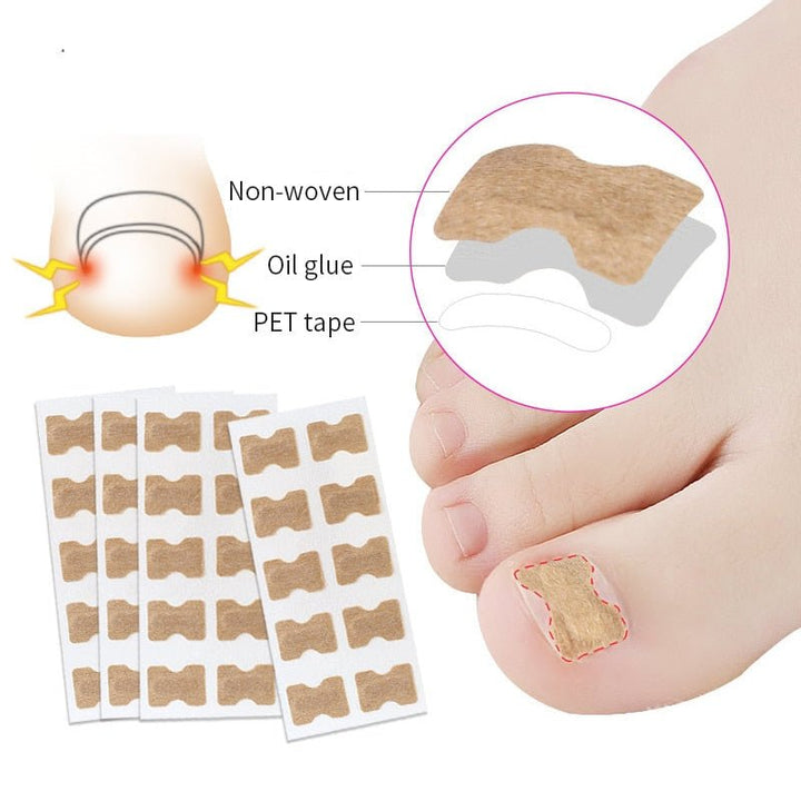 Skanto | Painless Toenail Patch - ToenailExpress