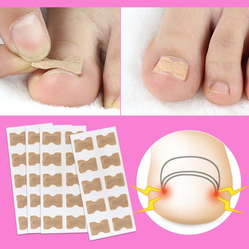 Skanto | Painless Toenail Patch - ToenailExpress