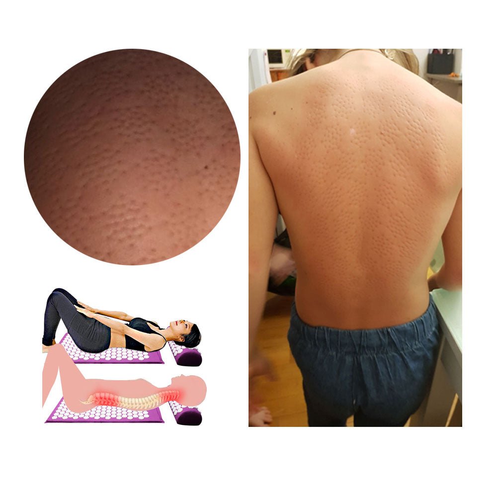 Norvo | RELAXPRESS – Akupressur Yoga Matta og Pute Sett for Optimal Avslapning og Smertelindring