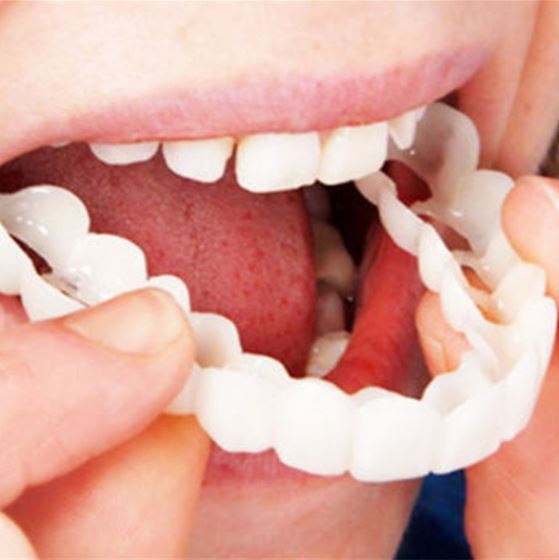Skanto | Snap-on Teeth™ - Med disse fasettene, ha alltid det perfekte smilet